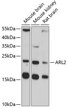 ARL2 Rabbit Polyclonal Antibody