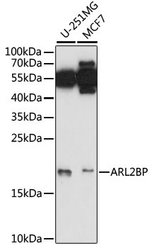 ARL2BP Rabbit Polyclonal Antibody