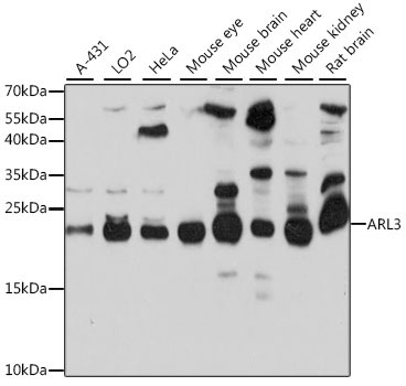 ARL3 Rabbit Polyclonal Antibody