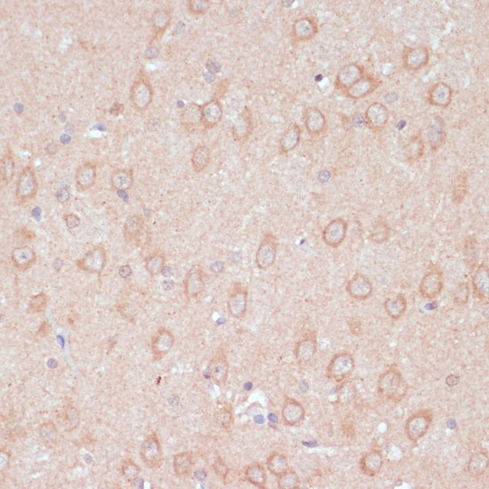 ARL4D Rabbit Polyclonal Antibody - Image 2