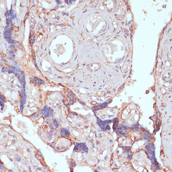 ARL4D Rabbit Polyclonal Antibody - Image 3