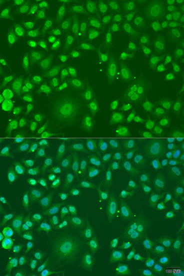 ARL6 Rabbit Polyclonal Antibody