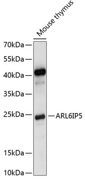 ARL6IP5 Rabbit Polyclonal Antibody