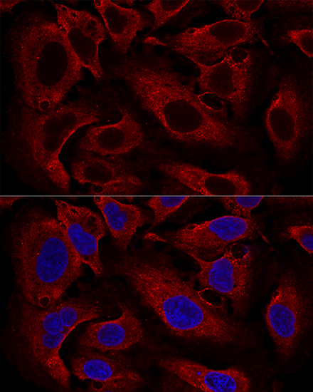 ARL8B Rabbit Polyclonal Antibody - Image 2