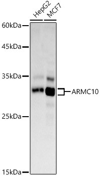 ARMC10 Rabbit Polyclonal Antibody