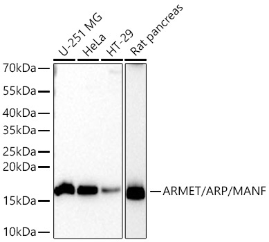 ARMET/ARP/MANF Rabbit Monoclonal Antibody