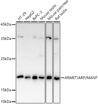 ARMET/ARP/MANF Rabbit Polyclonal Antibody