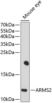ARMS2 Rabbit Polyclonal Antibody