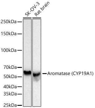 Aromatase (CYP19A1) Rabbit Monoclonal Antibody