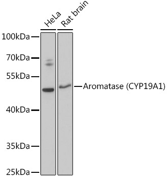 Aromatase (CYP19A1) Rabbit Polyclonal Antibody