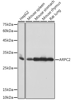 ARPC2 Rabbit Monoclonal Antibody