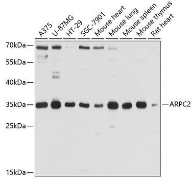 ARPC2 Rabbit Polyclonal Antibody