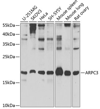 ARPC3 Rabbit Polyclonal Antibody