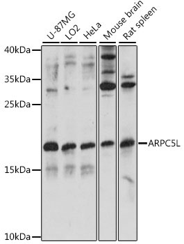 ARPC5L Rabbit Polyclonal Antibody