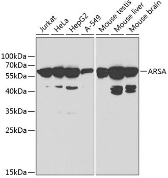 ARSA Rabbit Polyclonal Antibody