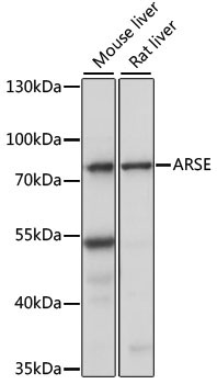 ARSE Rabbit Polyclonal Antibody