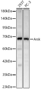 Arsk Rabbit Polyclonal Antibody