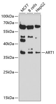 ART1 Rabbit Polyclonal Antibody