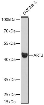 ART3 Rabbit Polyclonal Antibody