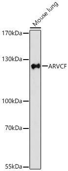 ARVCF Rabbit Polyclonal Antibody