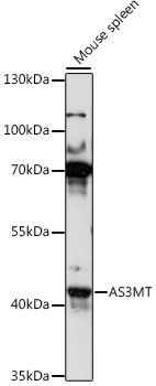 AS3MT Rabbit Polyclonal Antibody