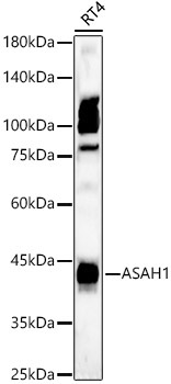 ASAH1 Rabbit Polyclonal Antibody