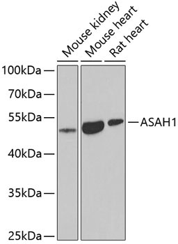 ASAH1 Rabbit Polyclonal Antibody