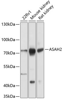 ASAH2 Rabbit Polyclonal Antibody