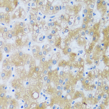 ASB4 Rabbit Polyclonal Antibody