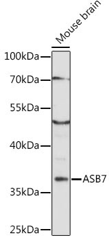 ASB7 Rabbit Polyclonal Antibody