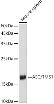 ASC/TMS1 Rabbit Polyclonal Antibody