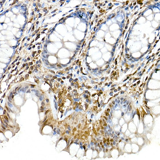 ASC/TMS1 Rabbit Polyclonal Antibody - Image 2