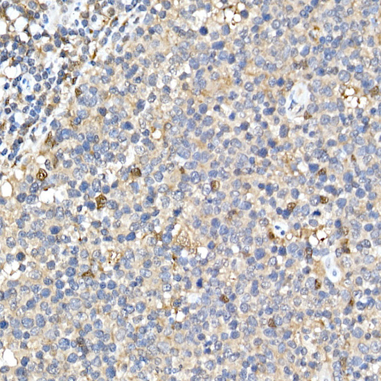 ASC/TMS1 Rabbit Polyclonal Antibody - Image 3