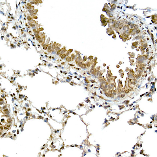 ASC/TMS1 Rabbit Polyclonal Antibody - Image 4