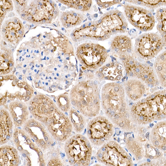 ASC/TMS1 Rabbit Polyclonal Antibody - Image 5