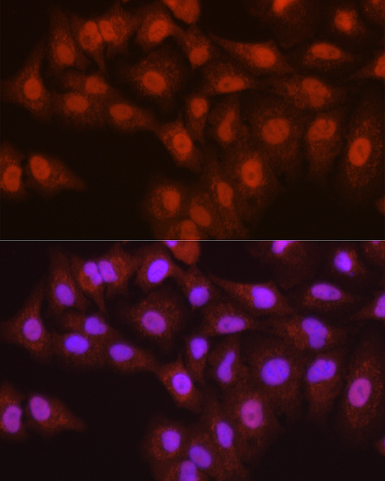 ASC/TMS1 Rabbit Polyclonal Antibody - Image 6