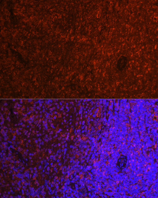 ASC/TMS1 Rabbit Polyclonal Antibody - Image 8