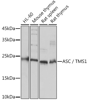 ASC/TMS1 Rabbit Polyclonal Antibody