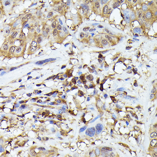 ASC/TMS1 Rabbit Polyclonal Antibody - Image 2