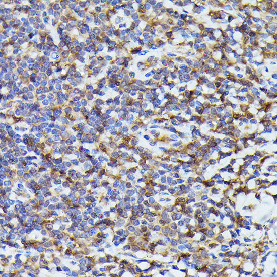 ASC/TMS1 Rabbit Polyclonal Antibody - Image 3