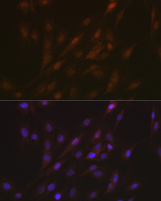 ASC/TMS1 Rabbit Polyclonal Antibody - Image 4