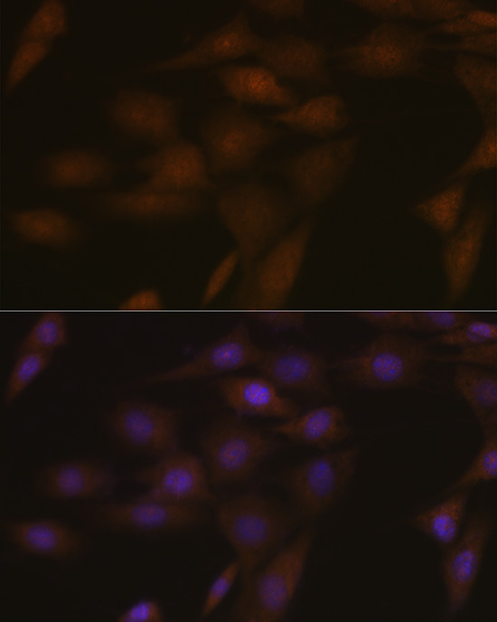 ASC/TMS1 Rabbit Polyclonal Antibody - Image 5