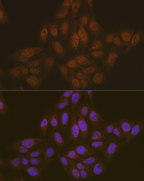 ASC/TMS1 Rabbit Polyclonal Antibody - Image 6