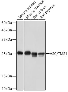 ASC/TMS1 Rabbit Polyclonal Antibody