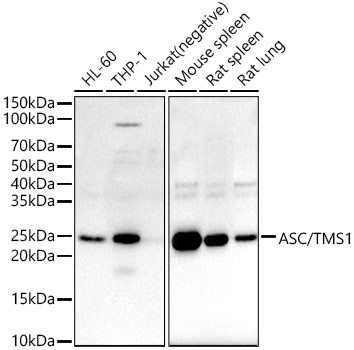 ASC/TMS1 Rabbit Polyclonal Antibody