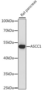 ASCC1 Rabbit Polyclonal Antibody