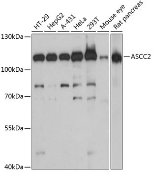 ASCC2 Rabbit Polyclonal Antibody