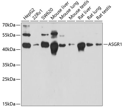 ASGR1 Rabbit Polyclonal Antibody