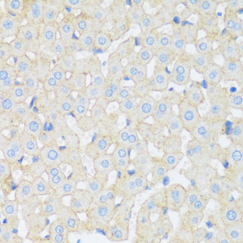 ASGR1 Rabbit Polyclonal Antibody - Image 2