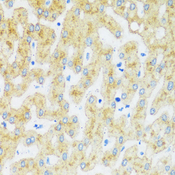 ASGR1 Rabbit Polyclonal Antibody - Image 3